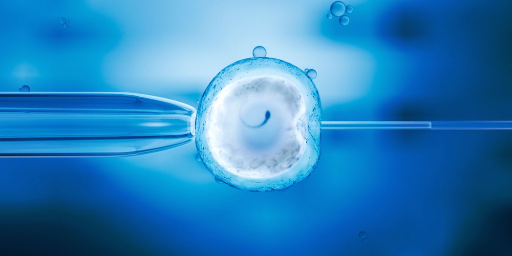 Fecundación In Vitro