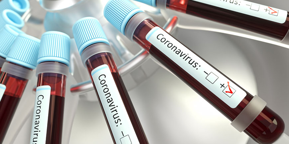 4 junio: 52 nuevos contagios, el mayor número de casos de Covid-19 en un solo día desde que inicio la emergencia sanitaria. Con Marco Vinicio Boza.