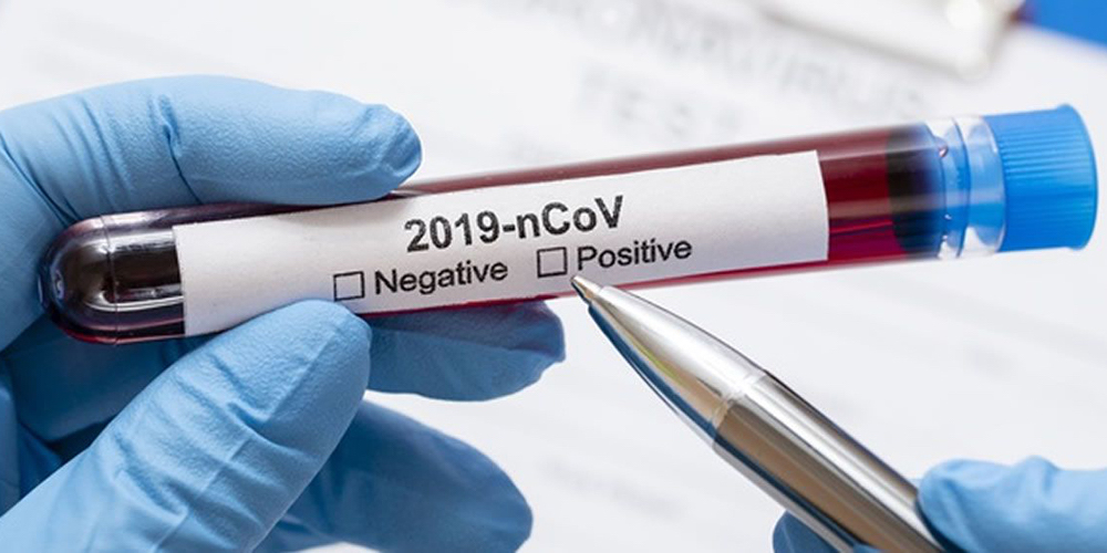 29 setiembre: 1 millón de muertes por Covid-19 a nivel mundial. Con Álvaro Avilés Montoya. 